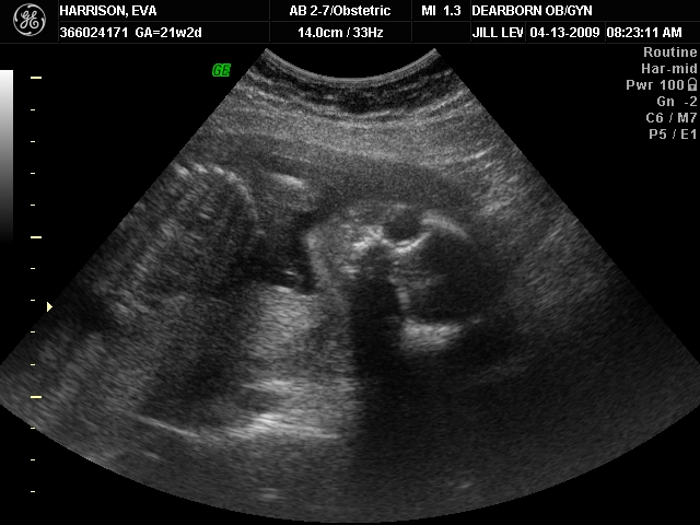 04-13-09 Baby 21 Weeks